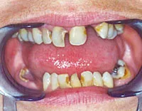 Before dental treatment photo
