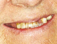 Smile Gallery photo