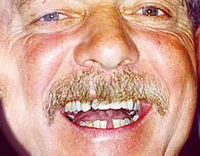 Smile Gallery before and after photos