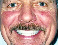 Smile Gallery After dental treatment photo