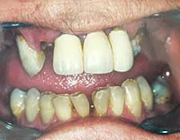 Before dental treatment photo