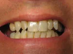 Before dental makeover