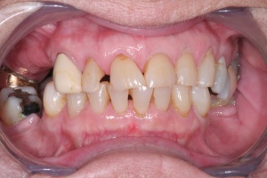 Smile Gallery before and after photos