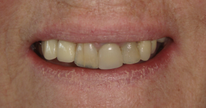 Smile Gallery photo