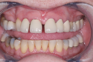 Smile Gallery photo