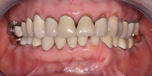 Before dental treatment photo