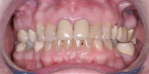 Smile Gallery photo