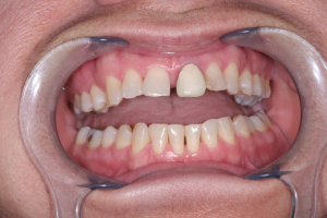 Smile Gallery photo