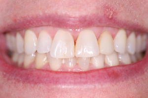 Smile Gallery photo