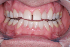Smile Gallery photo