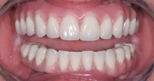 Smile Gallery before and after photos