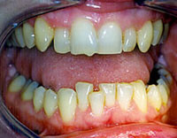 Smile Gallery photo