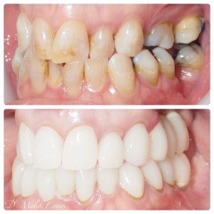 Smile Gallery before and after photo