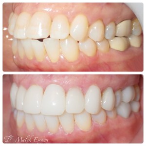 Smile Gallery before and after photo